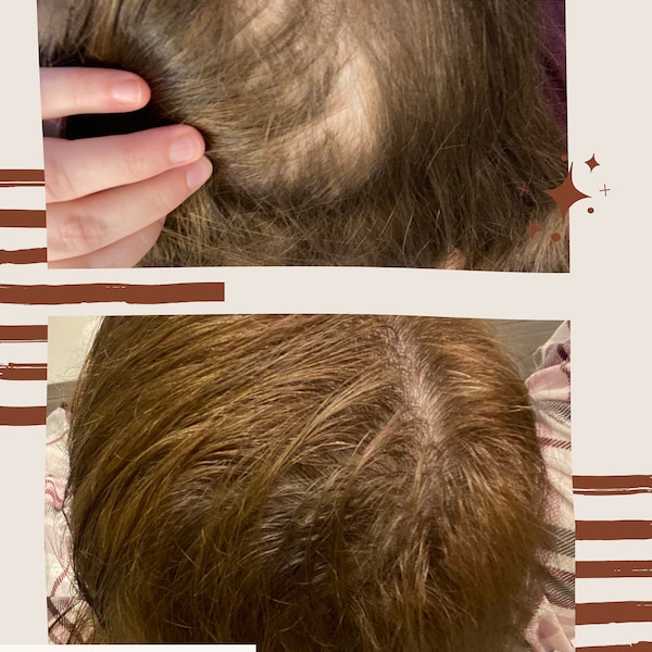 Hair Growth Serum | Non Oily Hair Growth | Non toxic Hair Growth | EO Free | Natural Hair Growth | Postpartum Hairloss | Caffeine based