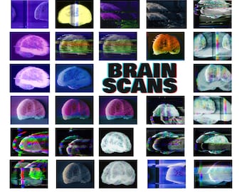 VHS Textures Background Pack - Brain Scans