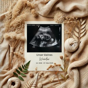 Announce pregnancy | Personalized ultrasound image template | Baby announcement | Pregnancy announcement for social media