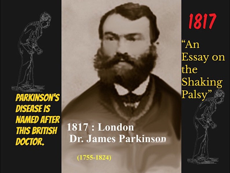History of Parkinsons Disease Etsy