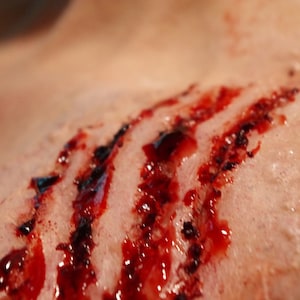 Pode incluir: Close-up de um ferimento sangrento com vários cortes profundos. O ferimento está coberto de sangue e parece ser fresco.