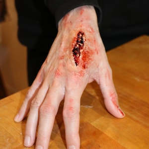 Silicone Hand Wound. Prosthetic Appliance for Film and TV. Casualty make-up, injury. Halloween SFX make-up and prosthetics.
