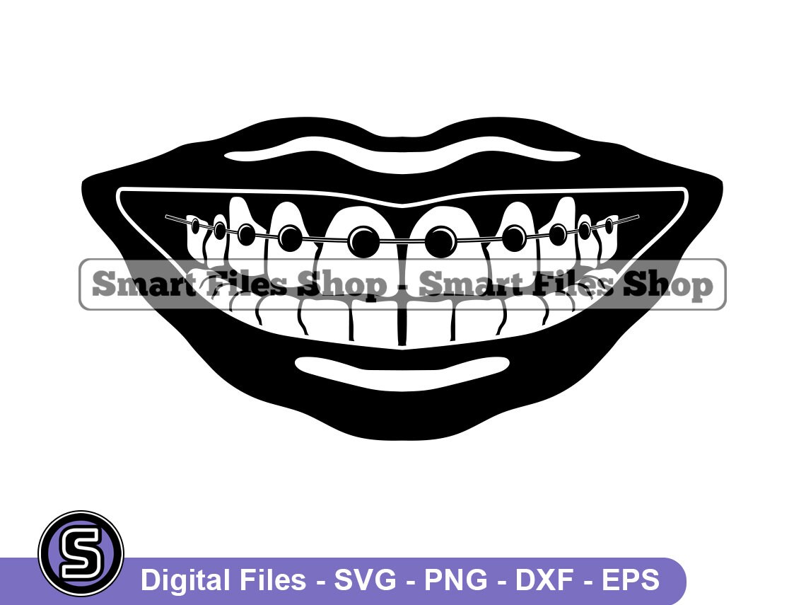 Braces SVG Teeth Svg Teens Svg Dentist Svg Braces Dxf - Etsy