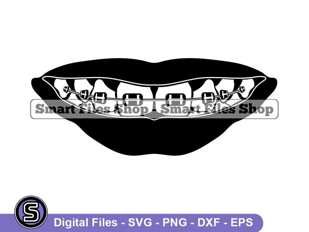 Braces 2 SVG, Braces SVG, Teeth Svg, Teens Svg, Dentist Svg, Braces Dxf