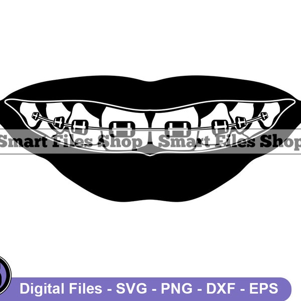 Braces #2 SVG, Braces SVG, Teeth Svg, Teens Svg, Dentist Svg, Braces Dxf, Braces Png, Braces Clipart, Braces Files, Eps