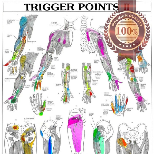 Trigger Points Part 2 Single Premium Waterproof Tear Proof Poster anatomisch diagram chart guide wall diagram Art Print