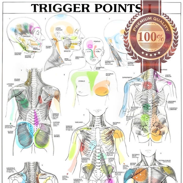 Trigger Points Part 1 Single Premium Waterproof Tear Proof Poster anatomisch diagram chart guide wall diagram Art Print