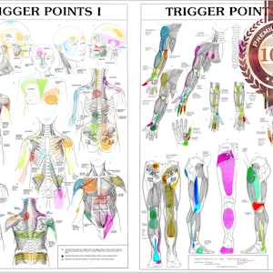 Abzugspunkte - Einzelnes Poster - Wasserdichter, reißfester anatomischer Schauplan, Wandkunst