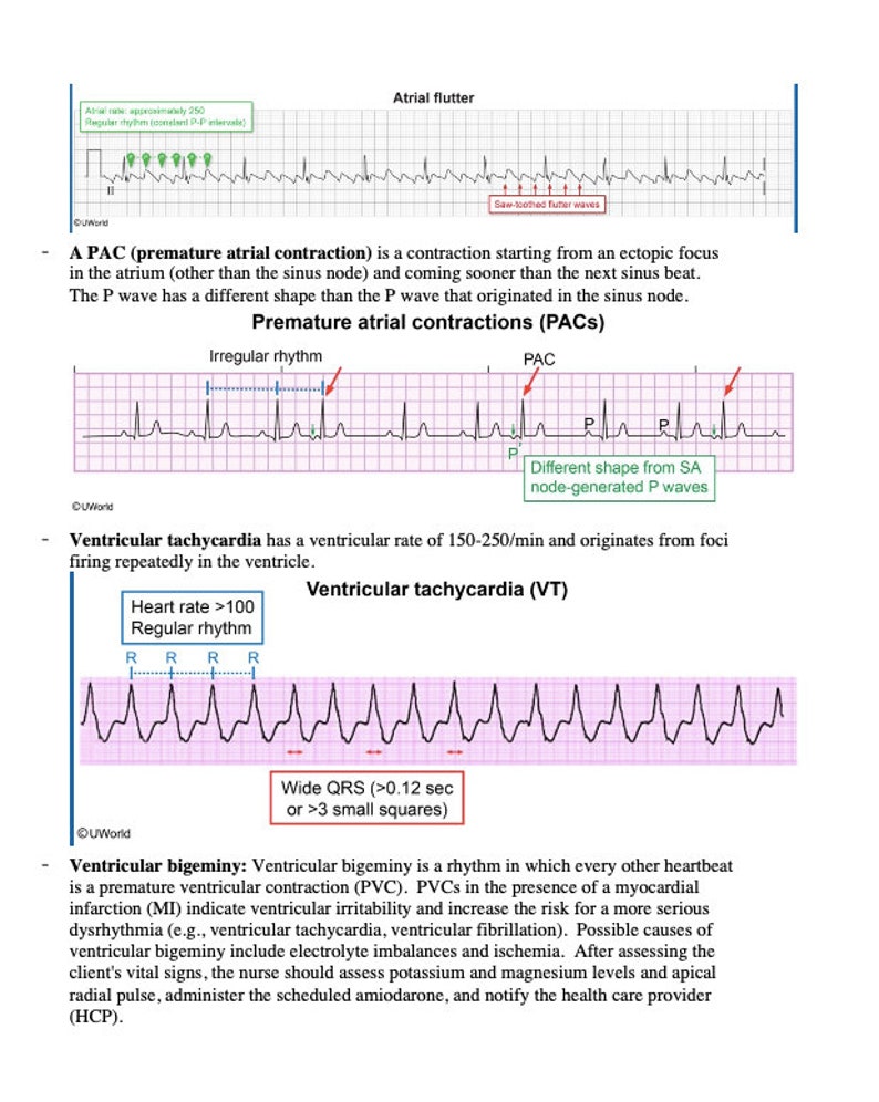 Pac Waveforms Strip Hurst NCLEX Review Notes | 75-page High-yield Study Guide (digital PDF ...