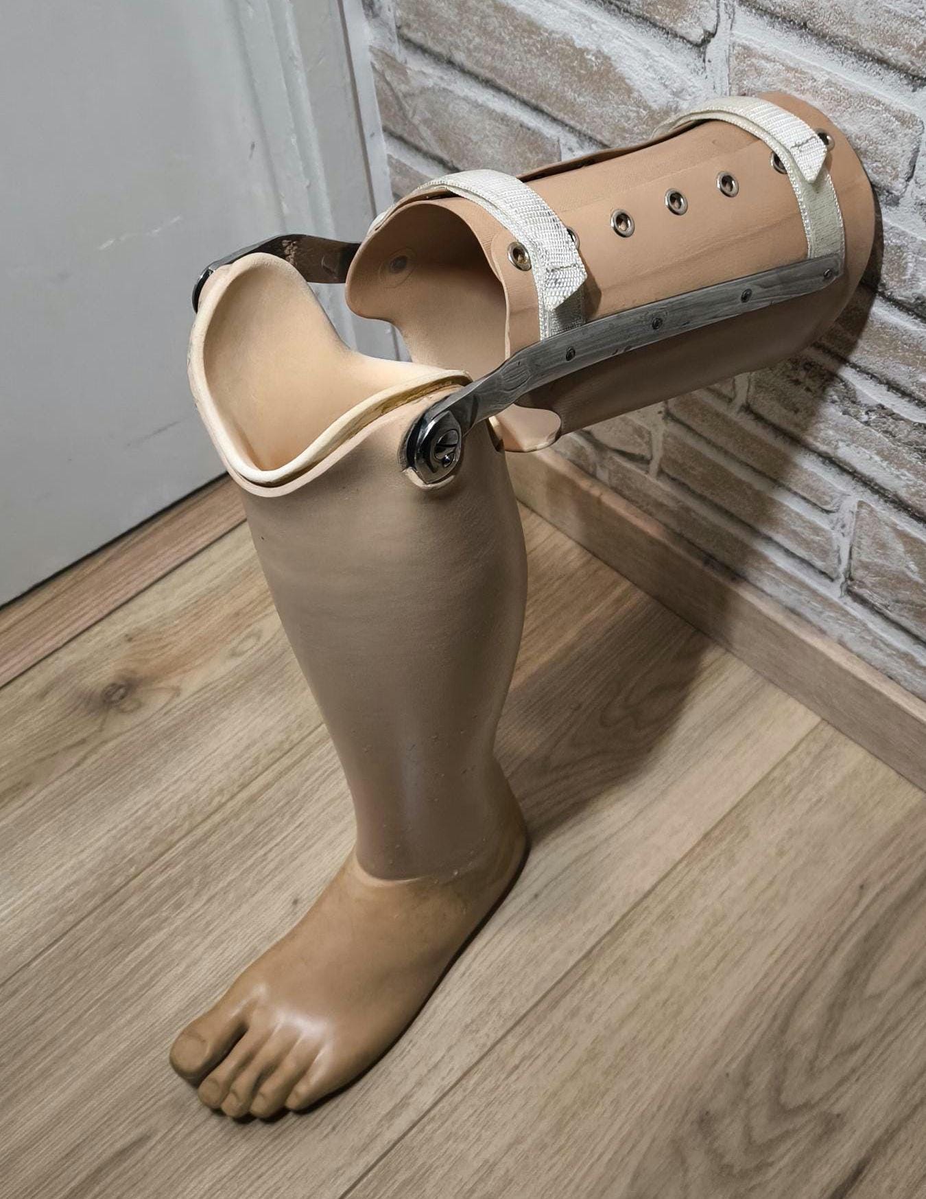 Arm amputation España