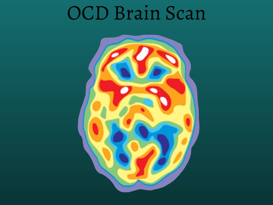 Ocd Brain Scan Obsessive Compulsive Chemical Imbalance Etsy Ocd Brain Scan Obsessive Compulsive Chemical Imbalance Etsy