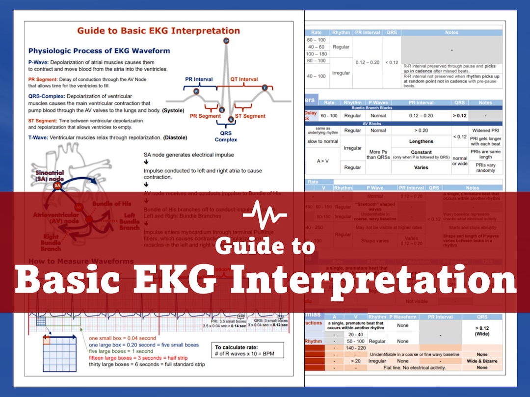 Ekg Interpretation Guide Etsy Ekg Interpretation Guide Etsy