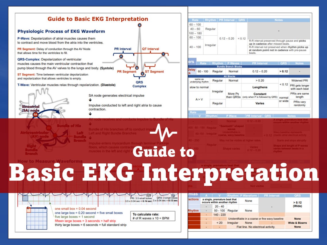 Perfect Ecg Interpretation Guide.pdf EKG Interpretation Guide - Etsy