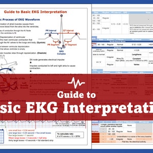 EKG Interpretation Guide
