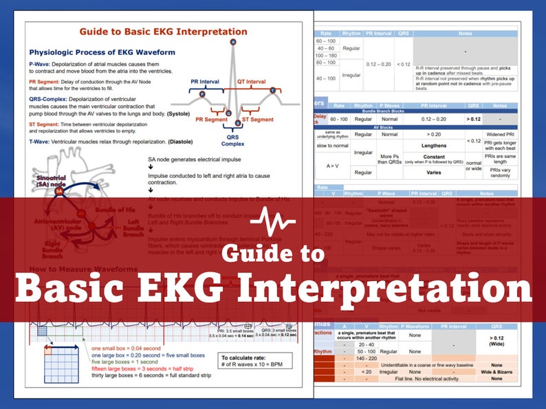 EKG Interpretation Guide - Etsy