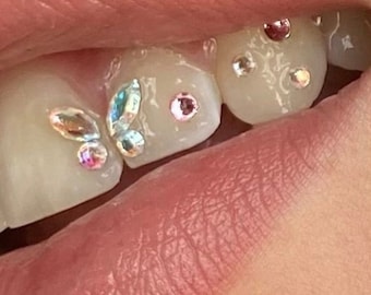DIY Tooth Gem Kit | Butterfly AB Set