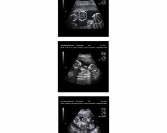 Fake Ultrasound Twins - Etsy