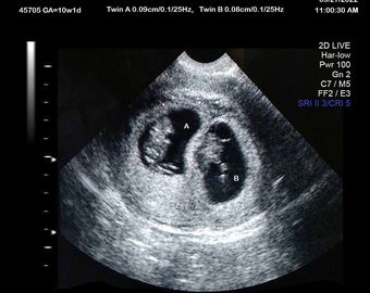 Fake Ultrasound Twins - Etsy UK