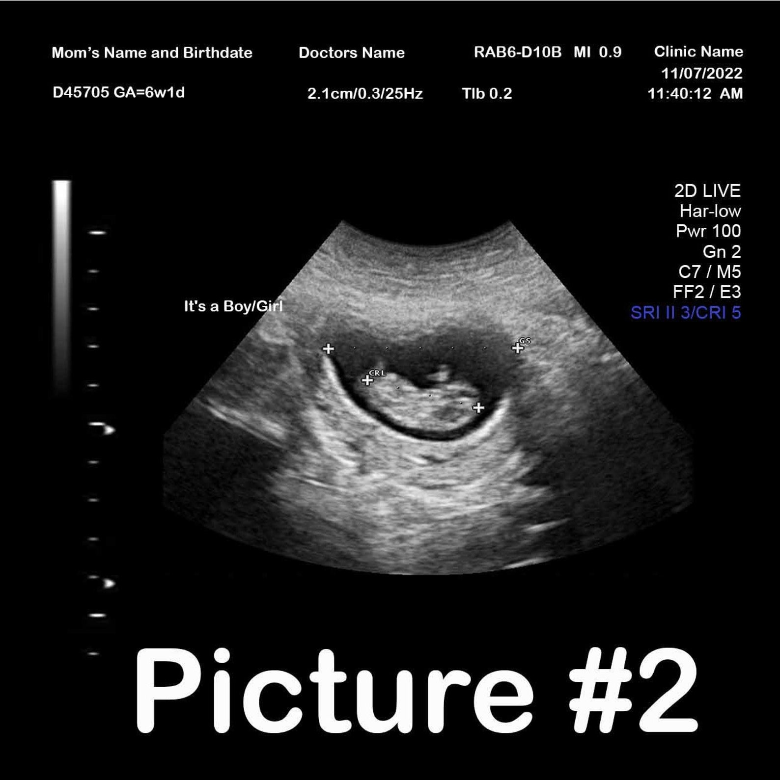 Fake Ultrasound Prank - ckef5k4