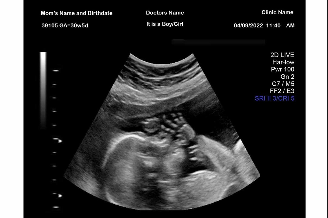 Digital Fake Ultrasound Prank Fetus / Baby at 30 Weeks Etsy