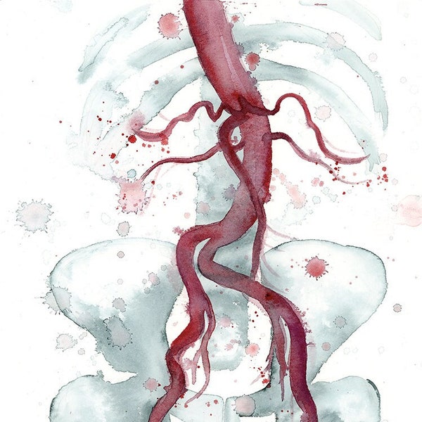 Aortoiliac Vasculature watercolor, fine art Giclee print