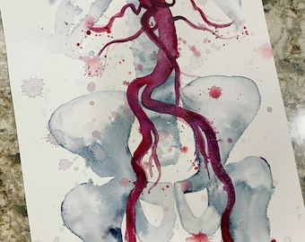 Aortoiliac Vasculature, 9x12" original hand-painted watercolor painting