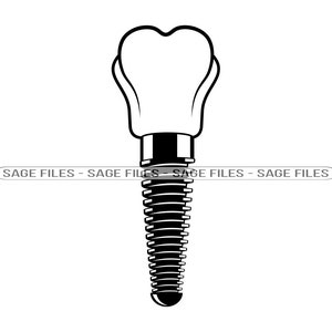 Implante dental SVG, dentista svg, diente svg, clipart de implante dental, archivos de implantes dentales para cricut, archivos de corte para silueta, png, dxf