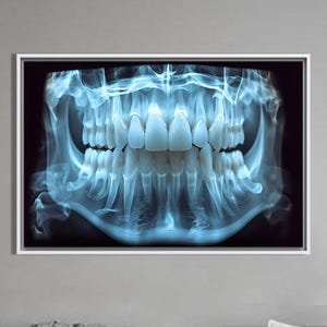 Dental X-Ray Art Poster, Anatomical Teeth Wall Art, Blue Radiograph Canvas, Dentist Office Decor, Dental Clinic Wall Print