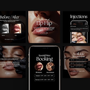 Botox Instagram Templates Black, Nurse Injector Templates, Botox and Filler Templates for Instagram, Med Spa Social Media Canva Templates