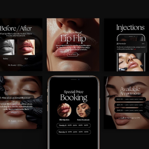 Botox Instagram Templates Black, Nurse Injector Templates, Botox and Filler Templates for Instagram, Med Spa Social Media Canva Templates