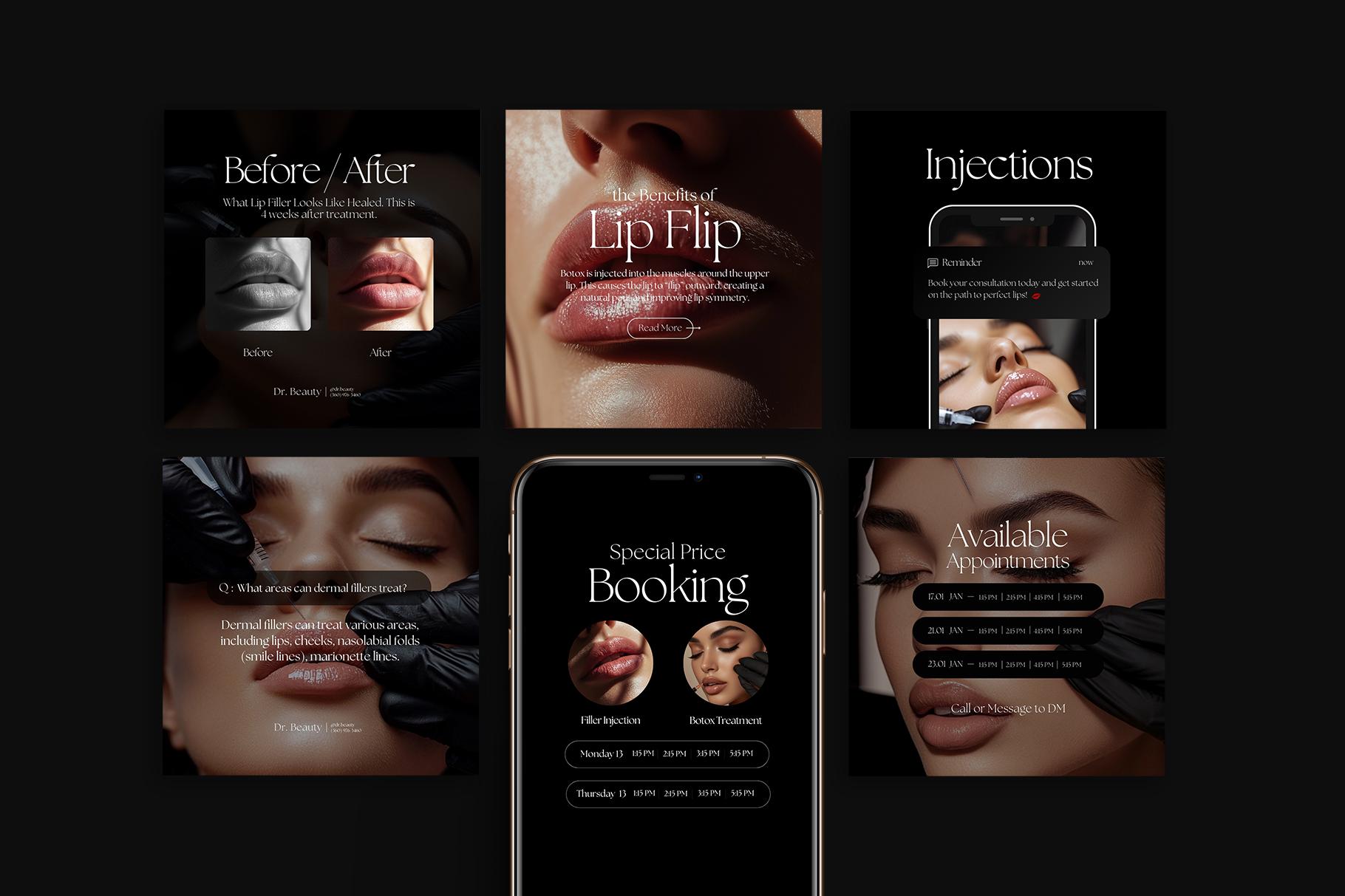 Botox Instagram Templates Black, Nurse Injector Templates, Botox and Filler Templates for Instagram, Med Spa Social Media Canva Templates