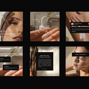 May include: A set of six Instagram posts on skincare. The first post features a woman's face with the text "HOW TO: PROTECT YOUR SKIN". The second post shows a hand holding a bottle of treatment essence with the text "TREATMENT ESSENCE". The third post shows a woman's leg with the text "ANNA MILLER". The fourth post shows a hand holding a dropper with the text "QUESTIONS & ANSWERS". The fifth post shows a woman's hair with the text "SKINCARE TIPS DOUBLE CLEANSING". The sixth post shows a woman's face with the text "ACNE CHECKLIST".