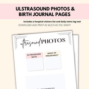Twin Pregnancy Journal, Twin Mom Pregnancy Planner PDF, Mom Of Twins Pregnancy Gift Keepsake, Twin Printables Pregnancy Tracker Memory Book image 4