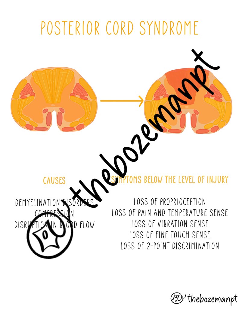Common Spinal Cord Injuries Handout and Study Guide Etsy