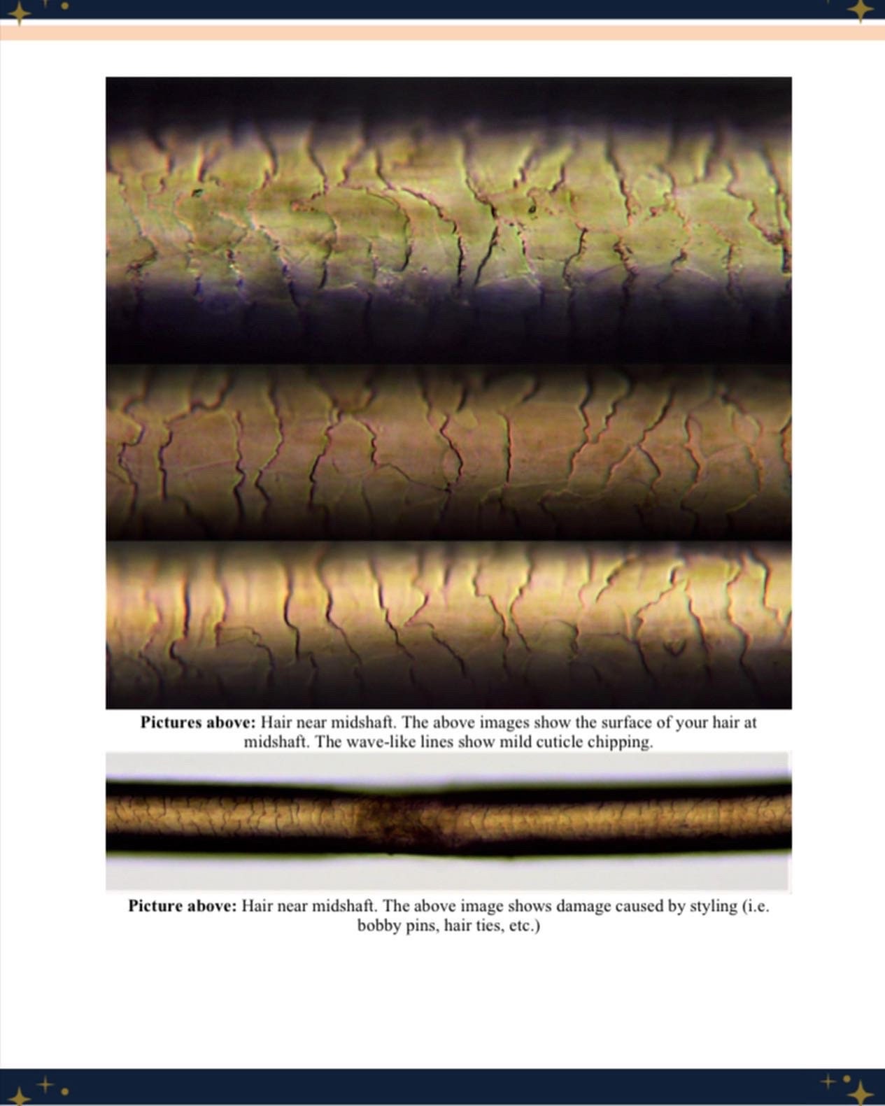 Microscopic Hair Analysis Etsy