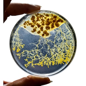Peut inclure: Une boîte de Pétri ronde et transparente contenant un échantillon biologique jaune et marron. L'échantillon présente une structure en réseau avec une section de formes irrégulières regroupées. Le plat est tenu par des doigts sur fond blanc.