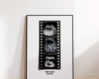 Ultrasound Kodak Film Custom Print Digital Wall Art Postpartum Gift Baby Shower Gift For Her Gift For Mom to Be Ultrasound Art