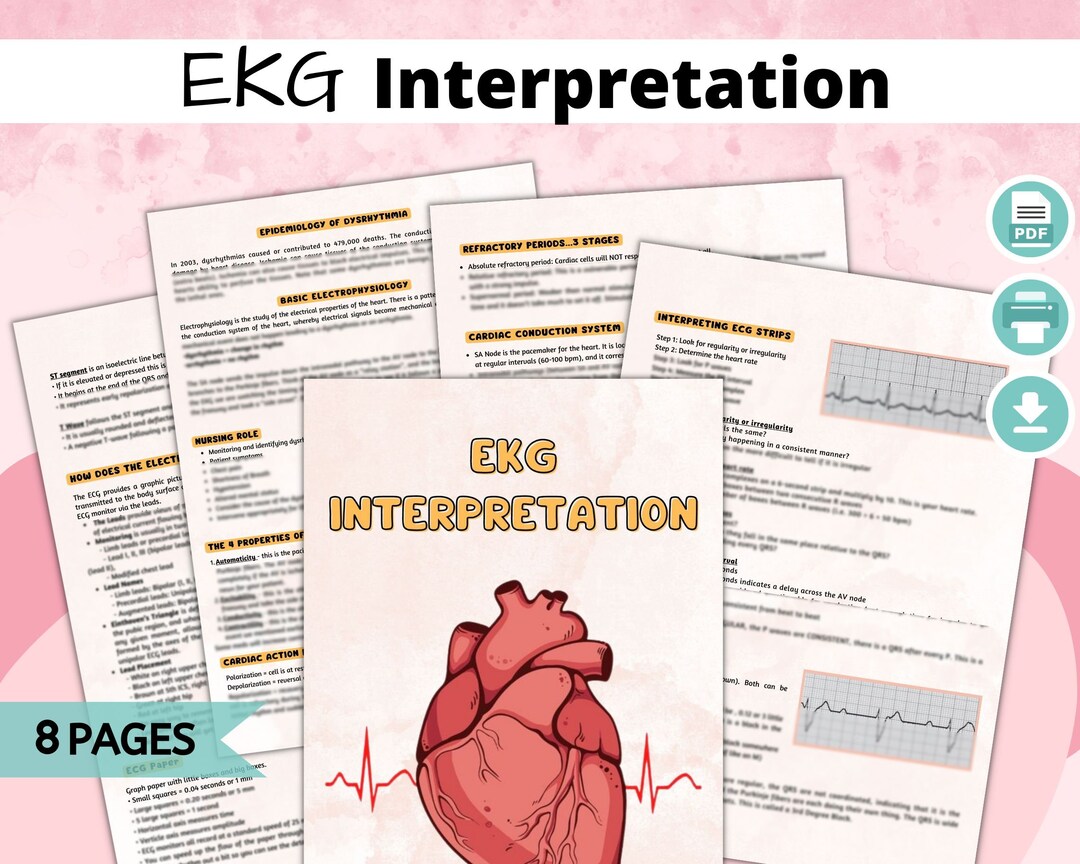 Ekg Study Guide, Ekg Interpretation, Ekg Rhythm, Ekg Cheat Sheet