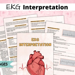 Ekg Study Guide, Ekg Interpretation, Ekg Rhythm, Ekg Cheat Sheet, Nursing Fundamentals, Critical Care Nurse, Med Surg Template, Rn Guide