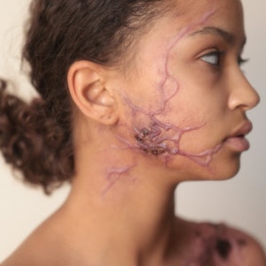 Infected Veins - Set of 2 prostheses