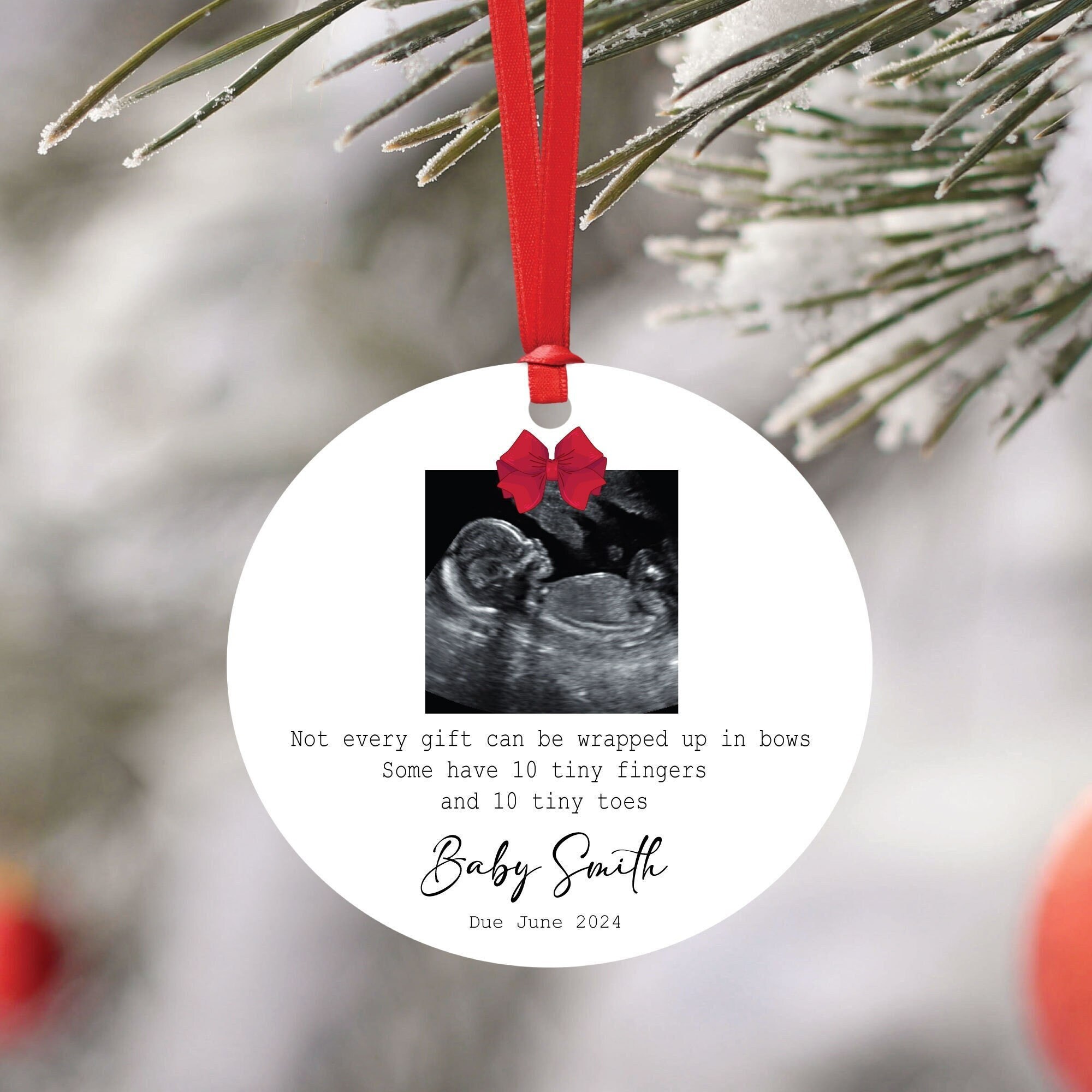 Pregnancy Announcement Baby Scan Bauble Sonogram Christmas Tree