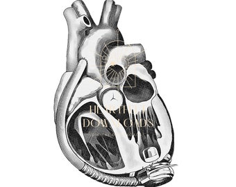 Blank LVAD PNG Graphic