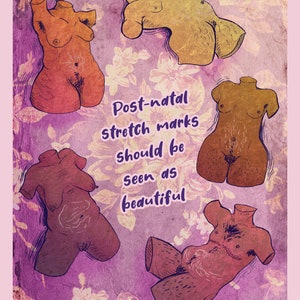 Post natal stretch mark should be seen as beautiful illustration féminsite et vintage pour déco, art lgbt+
