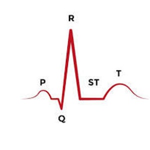 Notes sur l’ECG