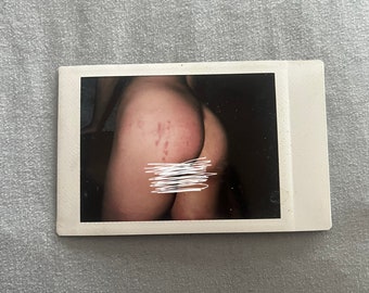 Bruised Ass Bdsm