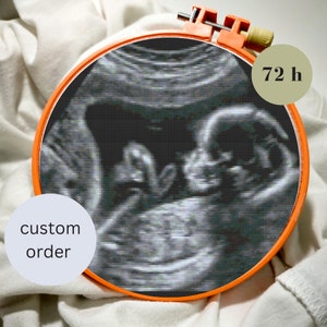 May include: A black and white ultrasound image of a baby in a circular embroidery hoop with an orange frame. The text "72 h" is on a light green background. The text "custom order" is on a light blue background.