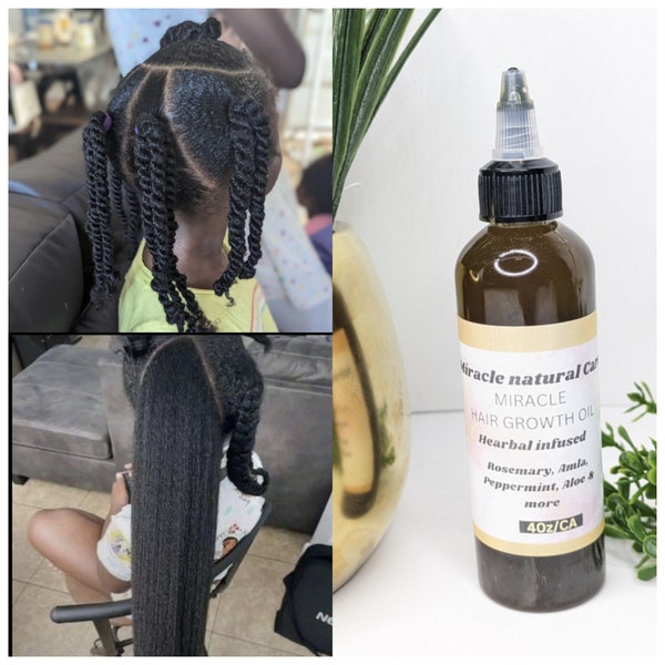 Hairgrowth oil,Fast hairgrowth oil, Grow Long thick healthyhair, Rosemary hair oil Ayurvedic hairgrowth oil,  Amla hair oil,  Scalp&hairoil