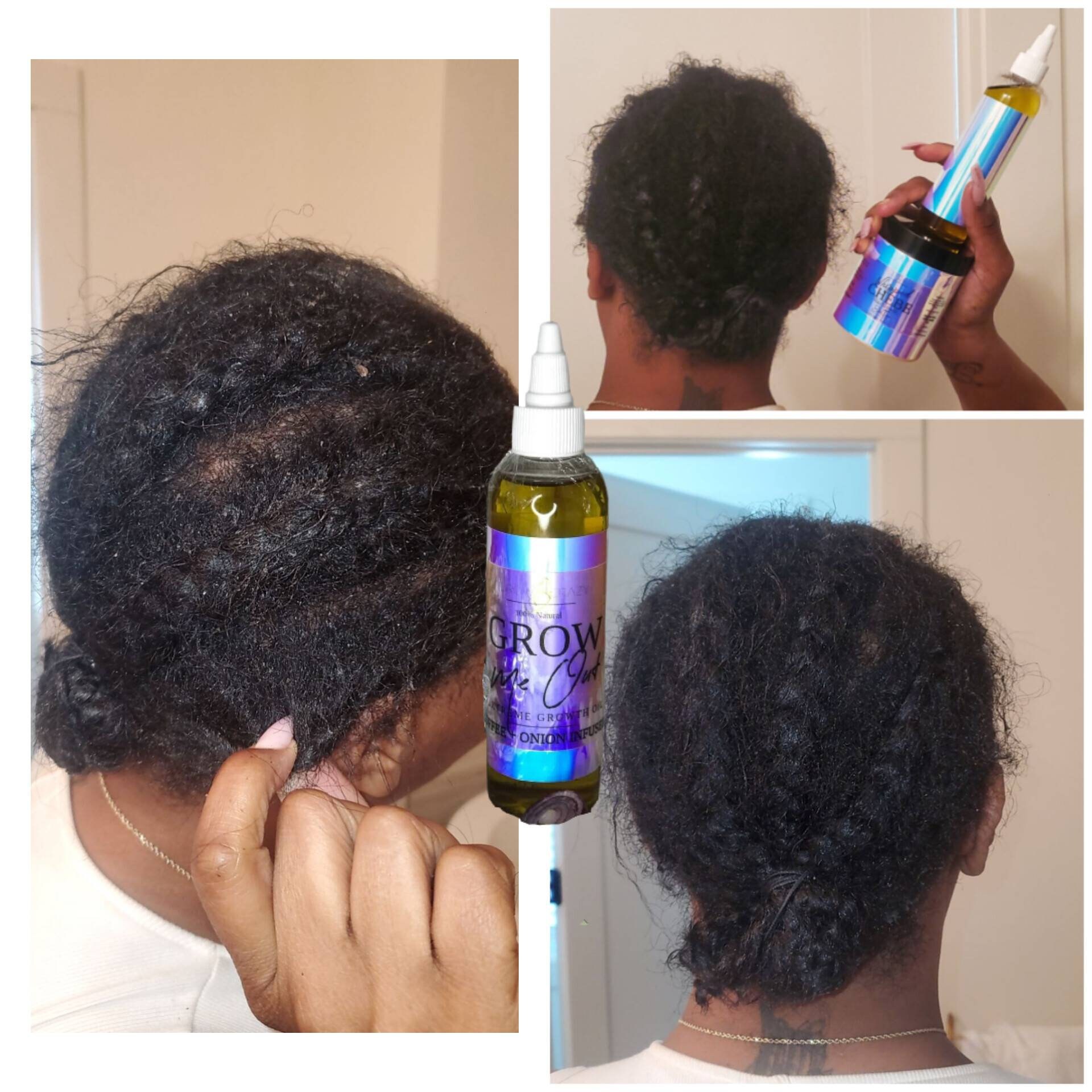 Onion and Coffee Extreme Growth Oil Etsy