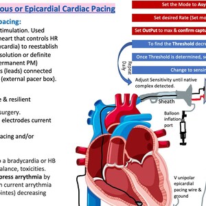 Puede incluir: Diagrama que ilustra la estimulación cardíaca transvenosa o epicárdica. La imagen muestra un corazón con cables de marcapasos, una pantalla de dispositivo médico y un diagrama de flujo que detalla el proceso. El texto incluye terminología e instrucciones médicas.