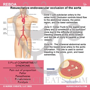 Side one of our REBOA badge buddy contains the zones of placement, documentation, and the 5 P's of compartment syndrome.